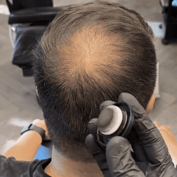 Hairline Powder